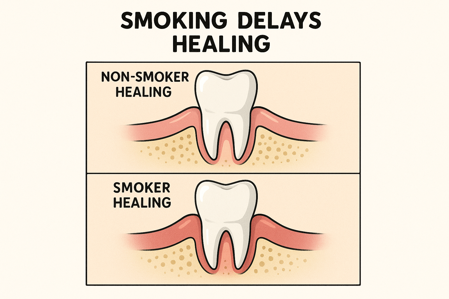 After a Root Canal Can You Smoke? Your Complete Recovery Guide