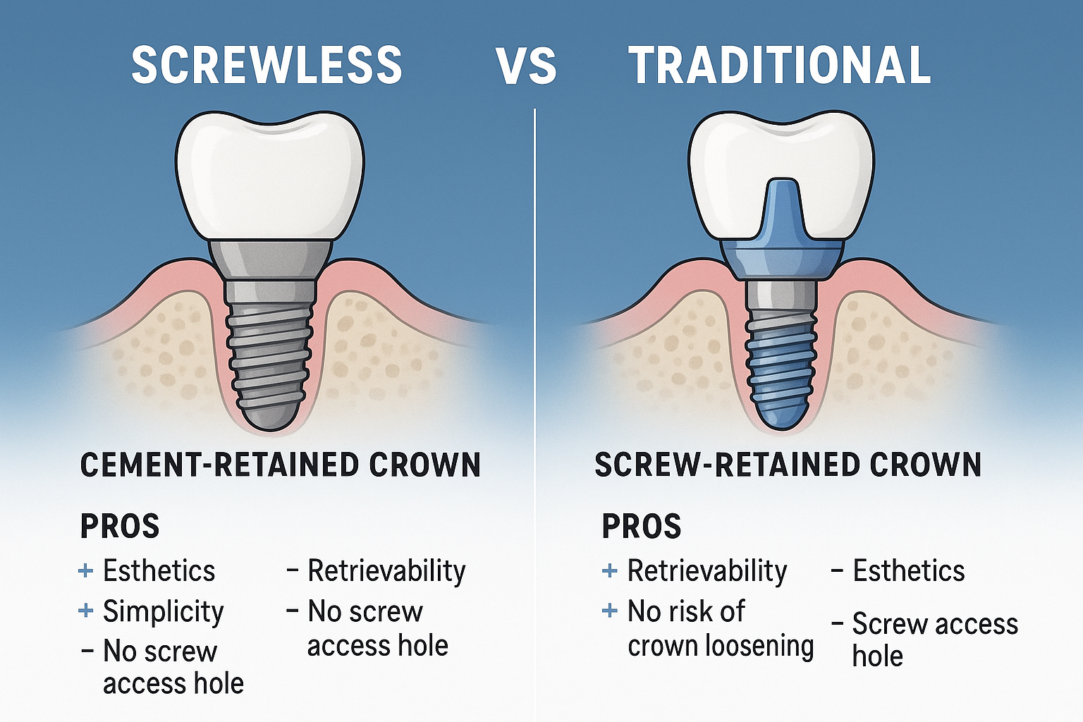 What Are Screwless Dental Implants? A Revolutionary Approach to Tooth Replacement