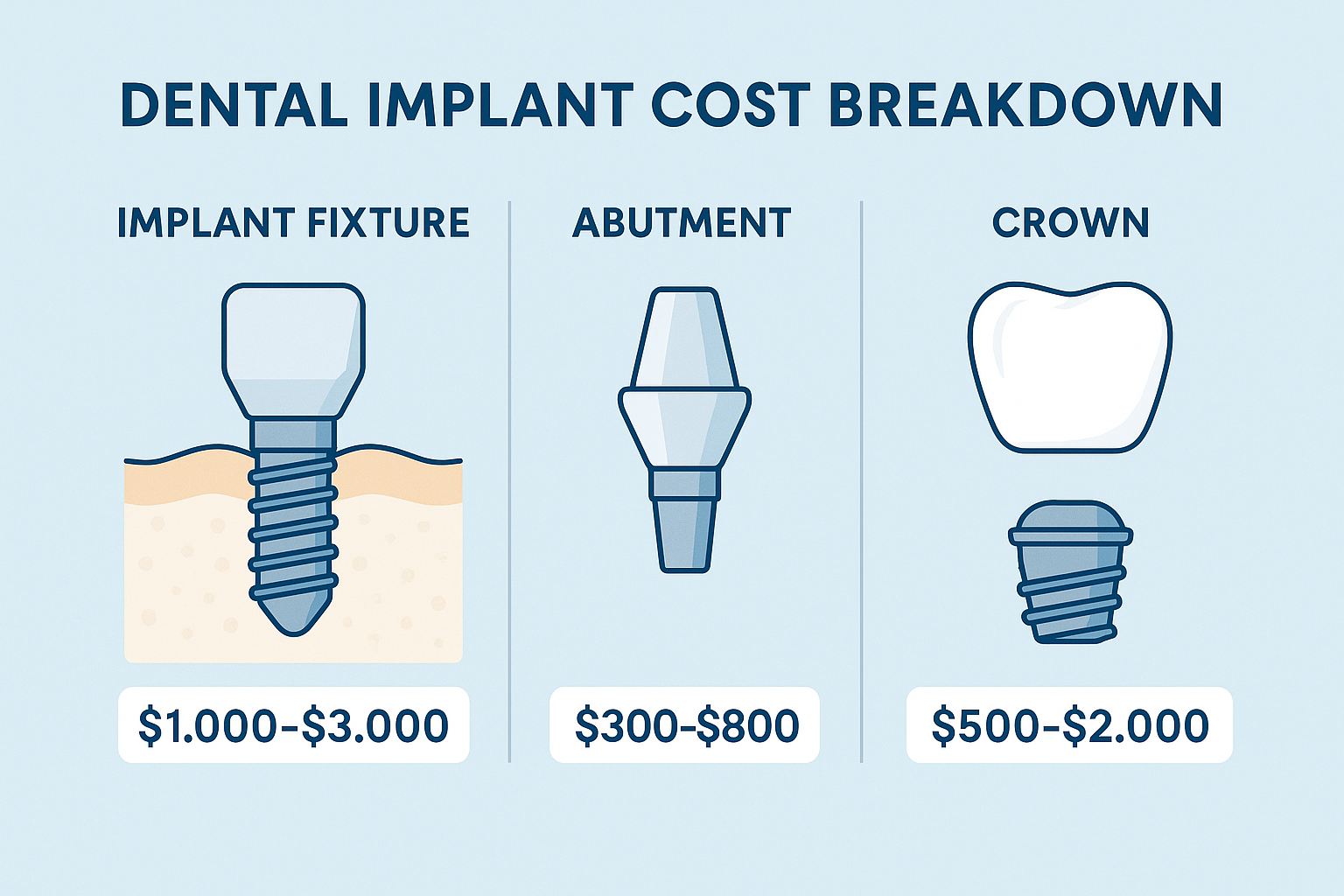 Complete Guide to Implantes Dentales Precio in 2025