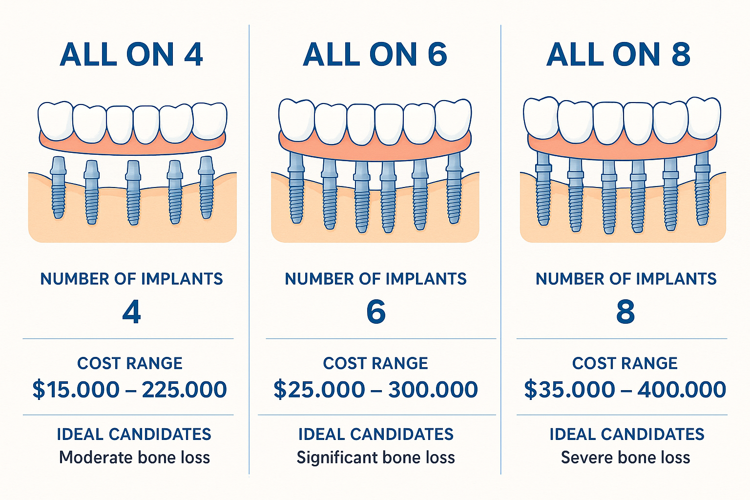 All on X Dental Implants: The Complete Guide to Full-Mouth Restoration in 2025