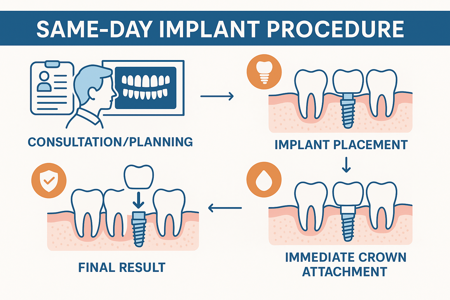 What Are Same-Day Implants? Your Complete Guide to Immediate Dental Restoration