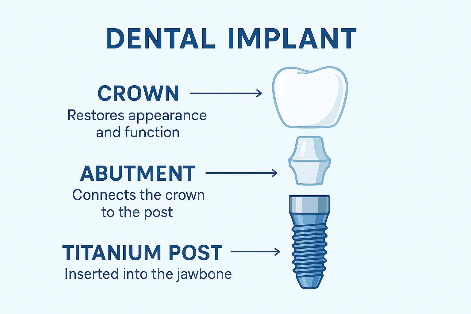 Dental Implants in Dallas, TX
