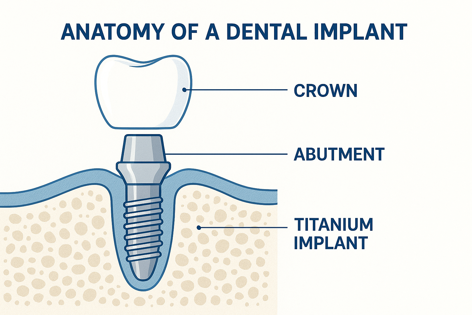 McFadden Dental: Your Complete Guide to Expert Dental Implant Care in 2025