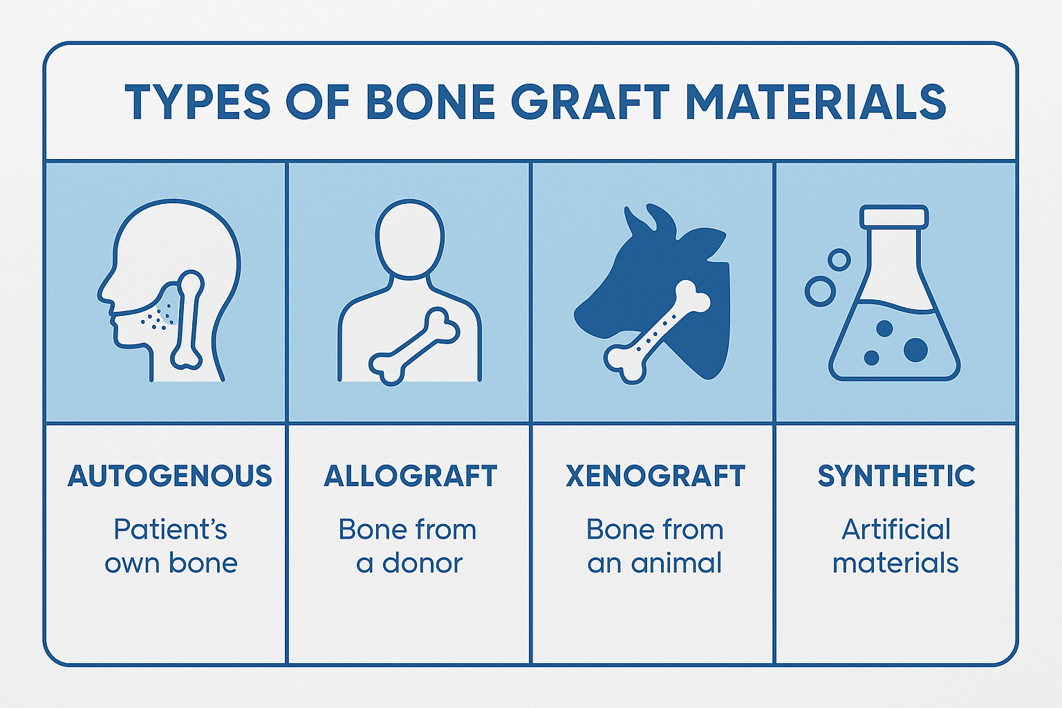 Bone Grafts for Dental Implants: Your Complete Guide to Successful Implant Placement