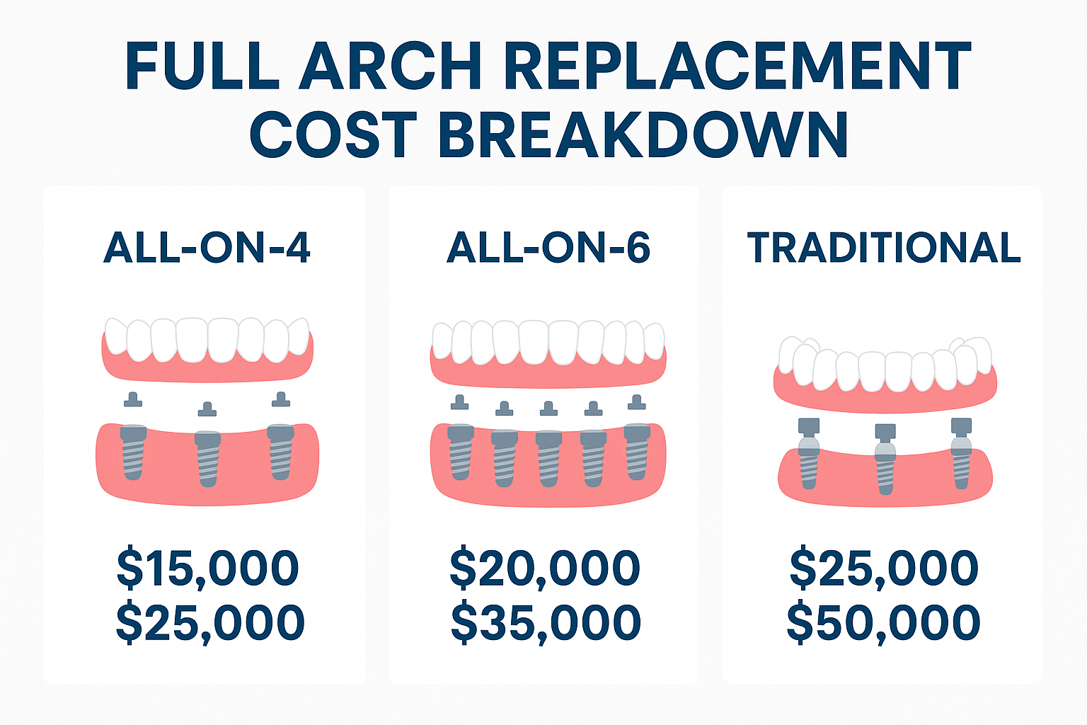 Your Complete Guide to Full Arch Replacement Cost Estimate in 2025