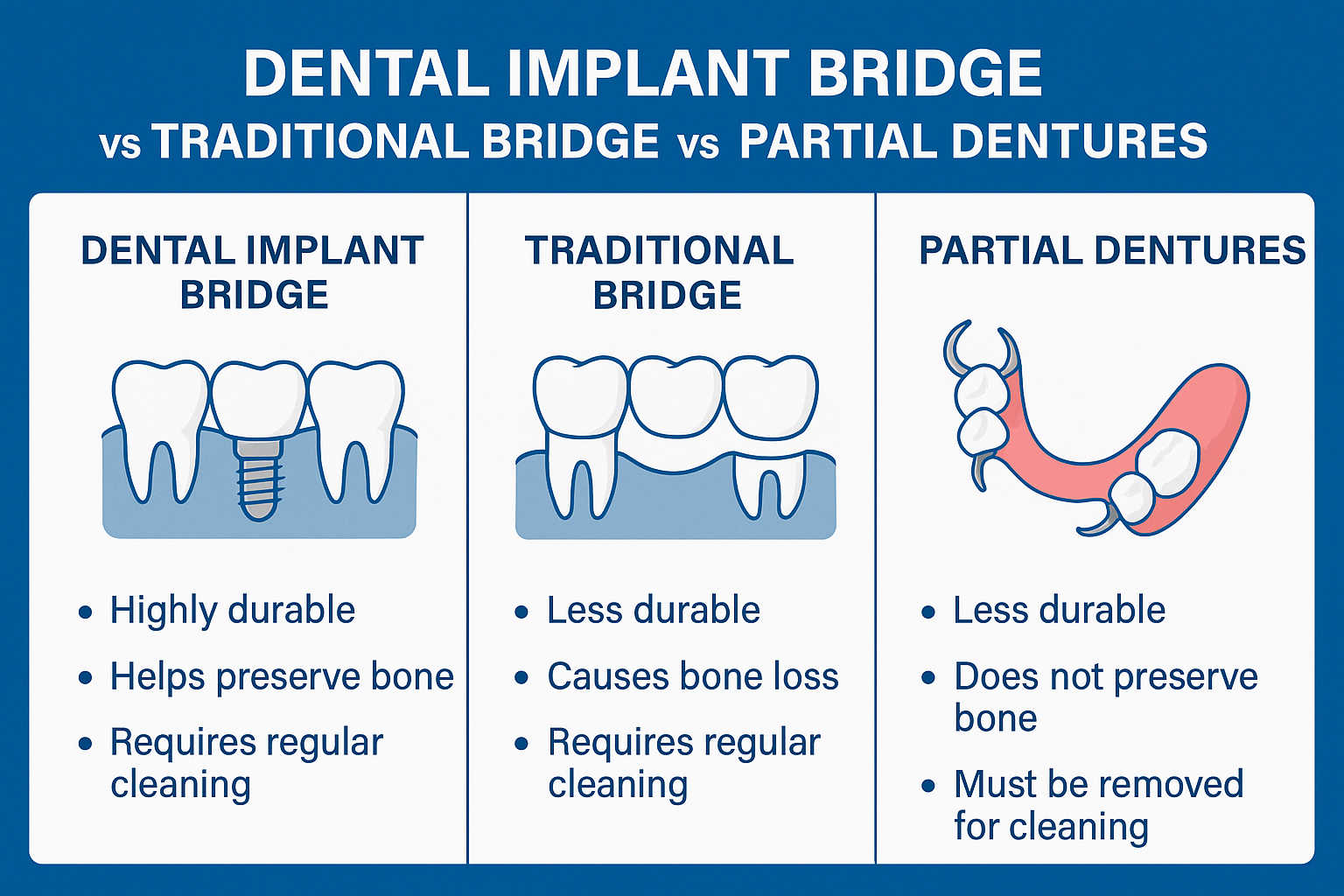 Dental Implant Supported Bridge: The Complete Guide to Permanent Tooth Replacement