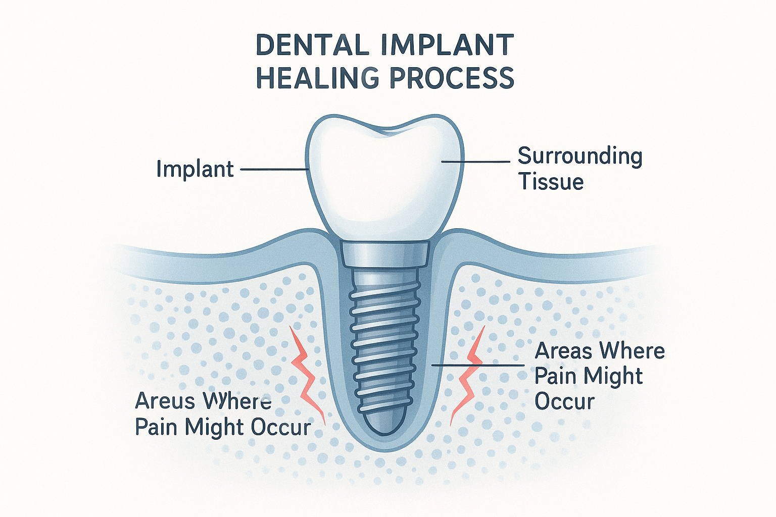 How to Relieve Pain from Dental Implant: Your Complete Guide to Post-Surgery Comfort