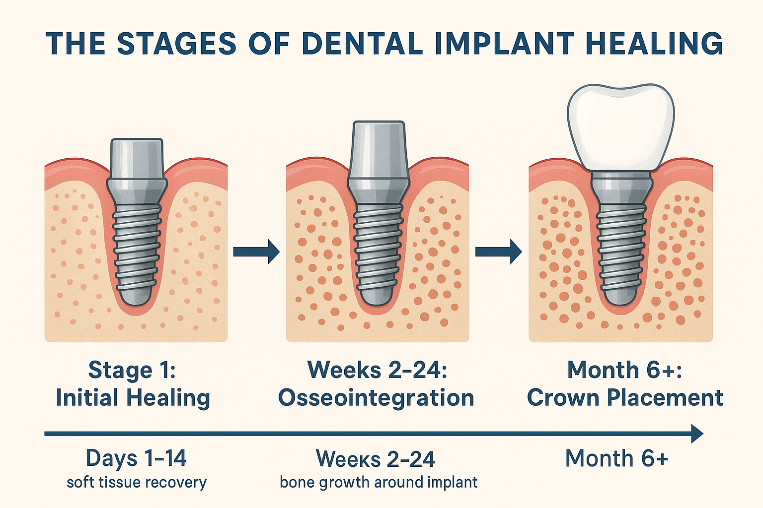 Dental Implant Healing Stages Pictures: Complete Visual Guide to Recovery 2025