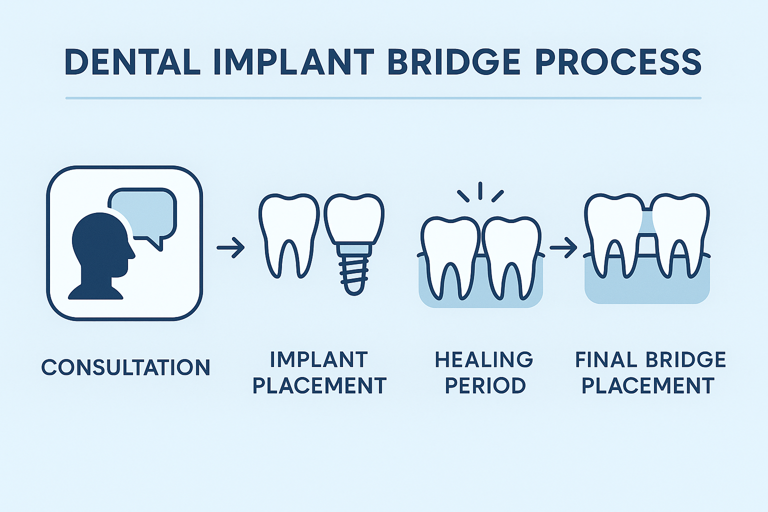 Dental Implant Bridge: Your Complete Guide to Life-Changing Smile Restoration in 2025