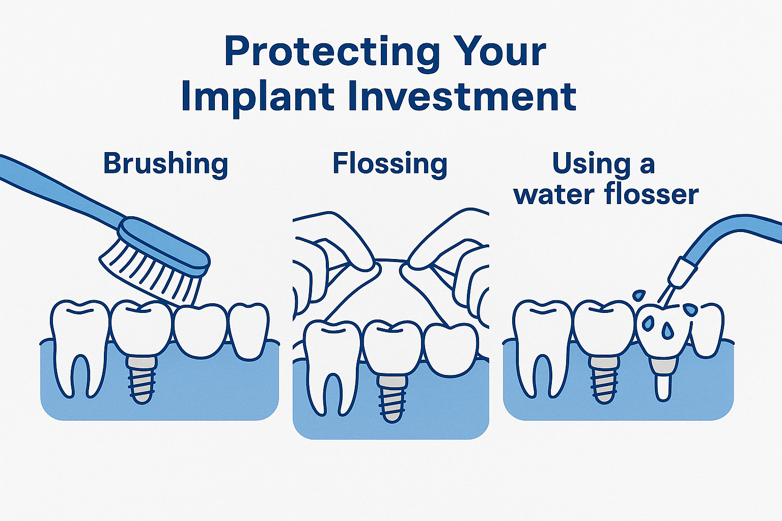 Complete Guide to Dental Implant Repairs NJ: When Your Implant Needs Professional Restoration