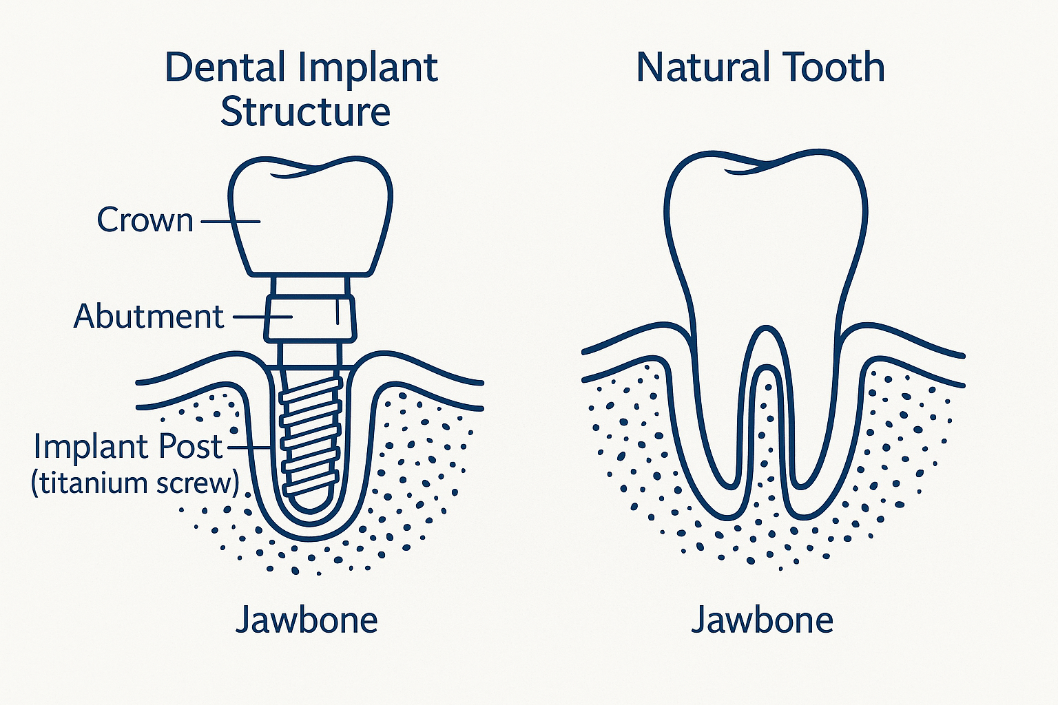 Dental Implants & Cosmetic Dentistry SW Smiles: Your Complete Guide to Confident Smiling in 2025