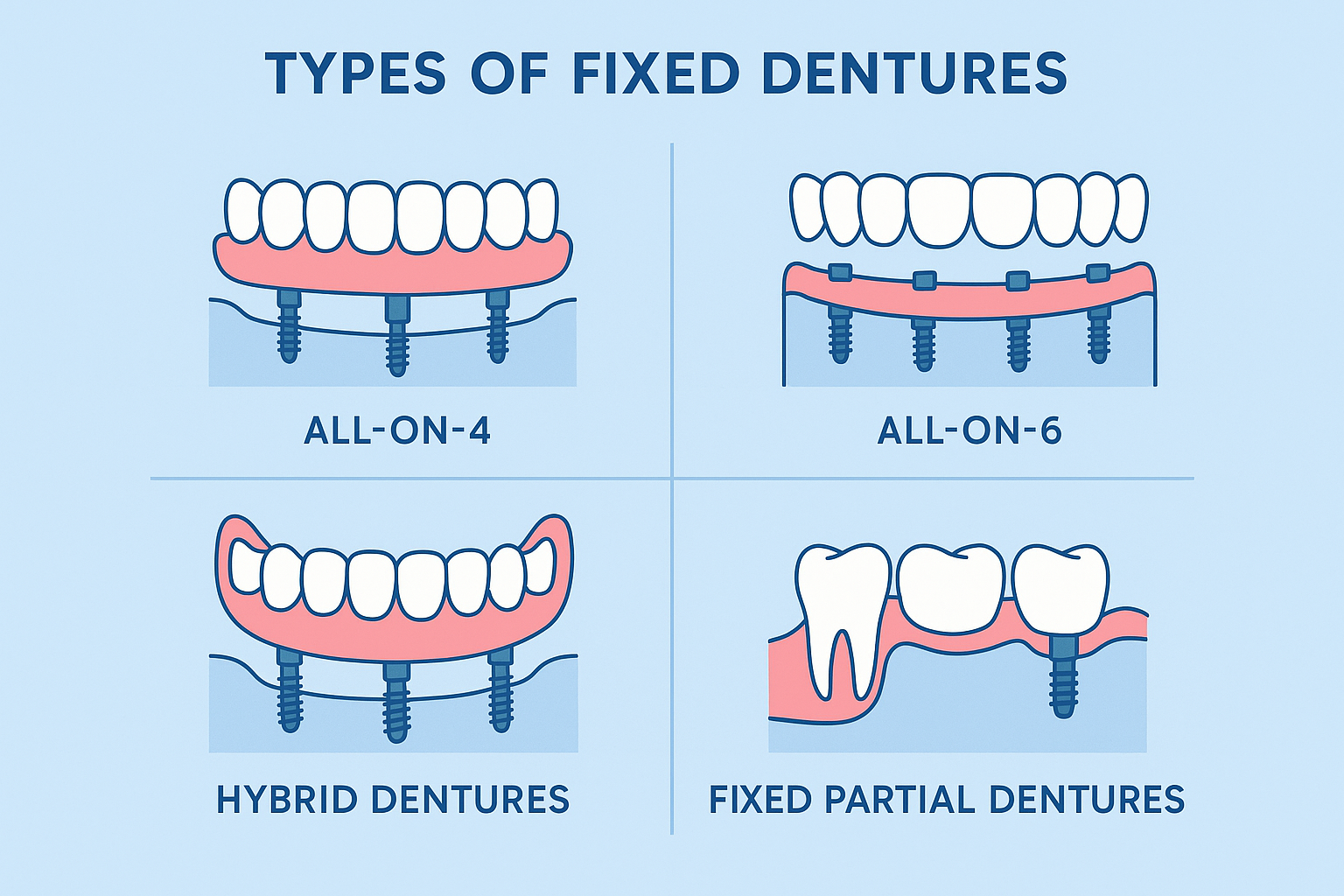Fixed Dentures: Your Complete Guide to Permanent Tooth Replacement Solutions in 2025