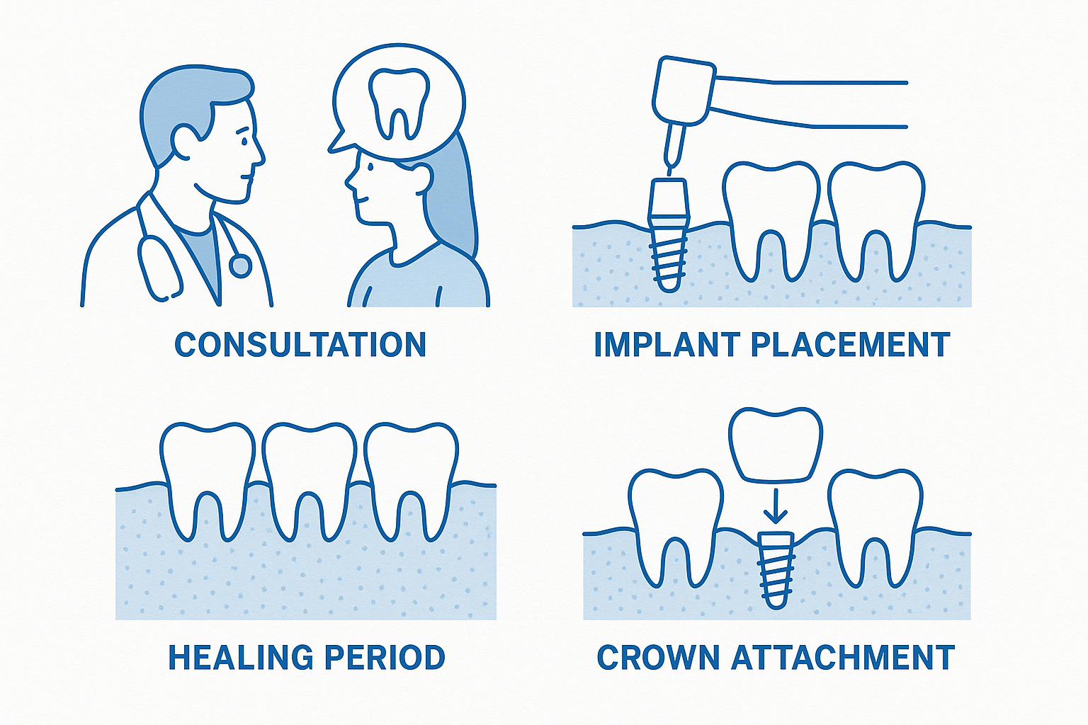 How Much Are Dental Implants in Mexico