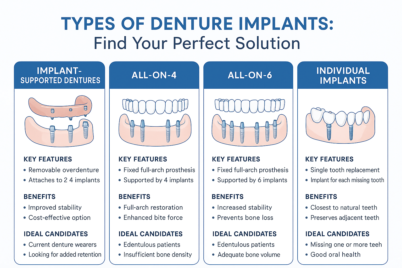 Create a detailed infographic in 1536x1024 landscape format comparing different types of denture implants. Show visual representations of im